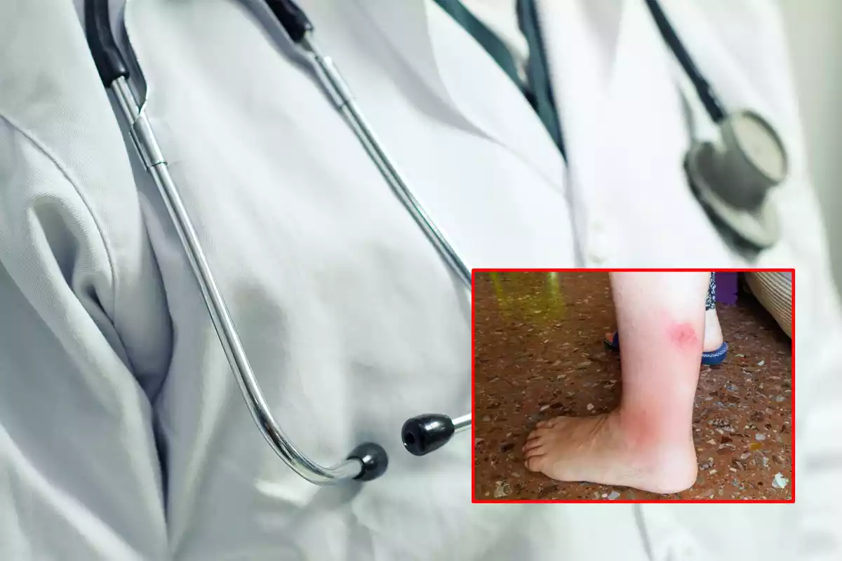 Una mordedura de mosca negra en una pierna sobre el fondo de un sanitario